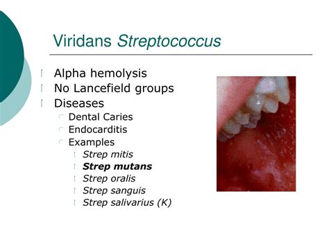 Ppt Streptococcus Powerpoint Presentation Free Download Id9528574