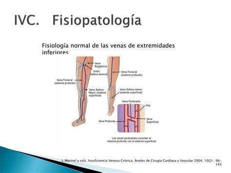 Ppt Insuficiencia Arterial Y Venosa Powerpoint Presentation Free Download Id
