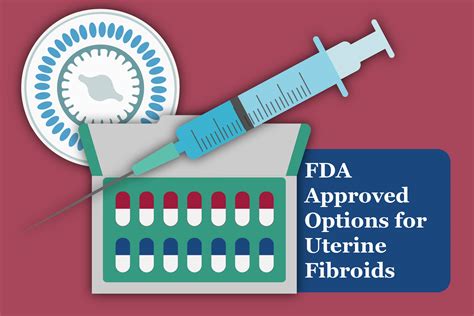 Fda Approved Options For Uterine Fibroids Emma International