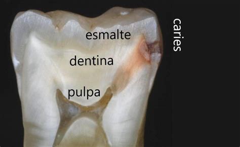 Odontología Conservadora Almela Dental