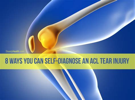 8 Ways You Can Self Diagnose An Acl Tear Injury Injuries Fractures