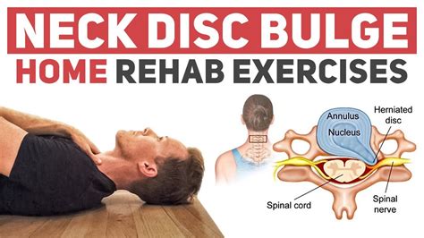 Neck Disc Bulge Herniation Rehab Exercises Youtube