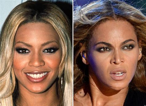 Before And After Beyonce Plastic Surgery Beyonce Nose Job Beyonce