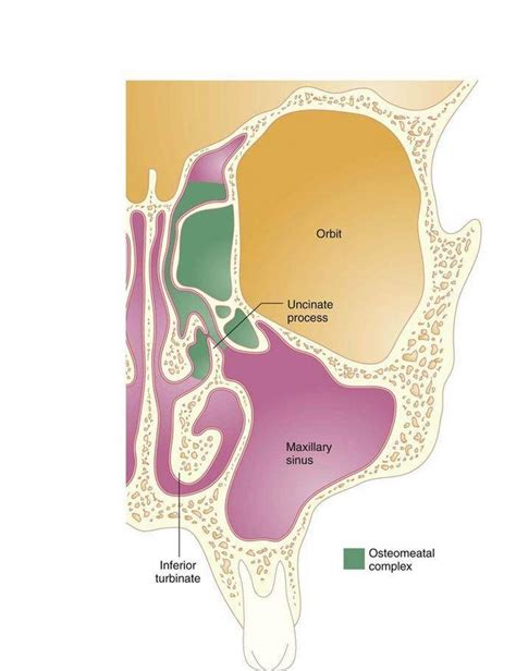 Pictures Of Anterior Ethmoid Sinuses