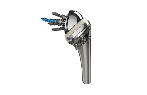 Fda Clears Depuy Synthes Inhance For Total Shoulder Arthroplasty