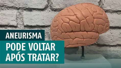 It may also burst or rupture, spilling blood into the surrounding tissue (called a hemorrhage). Aneurisma Cerebral pode voltar após tratamento? - YouTube