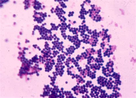Staphylococcus Aureus Bakteri Gram Homecare