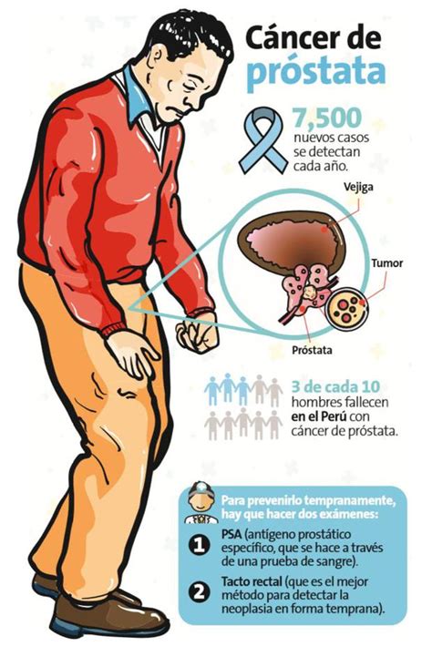 Cancer De Prostat Cauze Simptome Tratament Que Es El C Ncer De Pr Stata