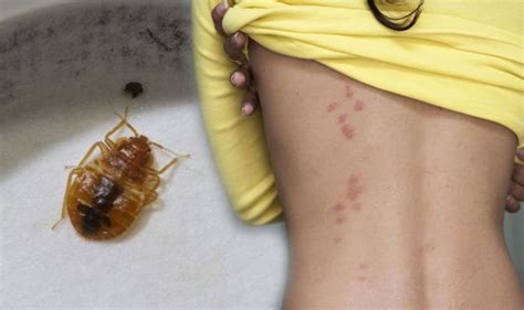 However, they will not become infested with them. Be Aware of the Reasons Causing Bed Bug Infestation at ...