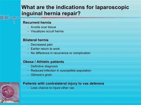 Laparoscopic Inguinal Hernia Surgery Anatomy