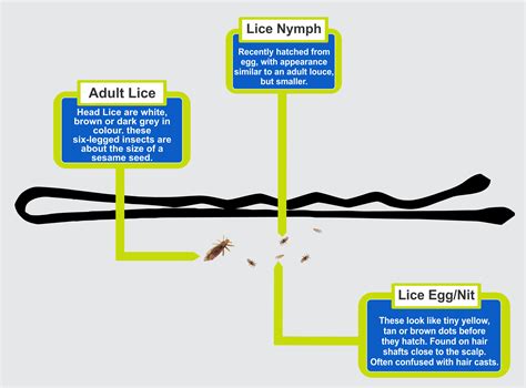 Different Ways Lice Can Be Identified Treet It Anti Lice