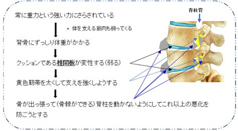 腰部脊柱管狭窄症 | 愛知医科大学病院