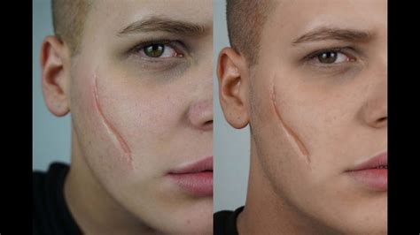 Pin By Jessica Cook On Facial Scars Face Scars Scar Makeup Facial Scars