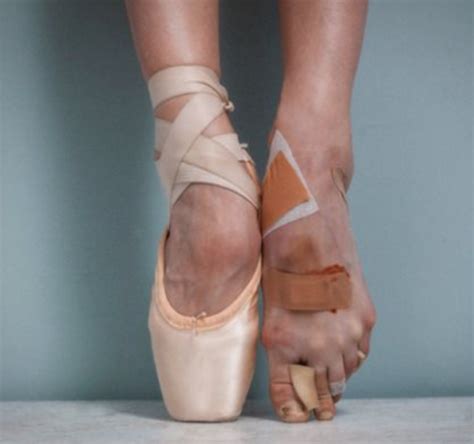 Does Ballet Ruin Your Feet