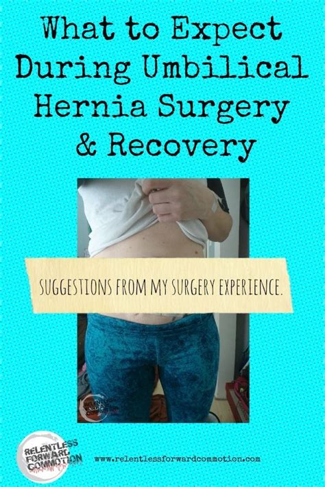 What To Expect During Umbilical Hernia Surgery Recovery Umbilical