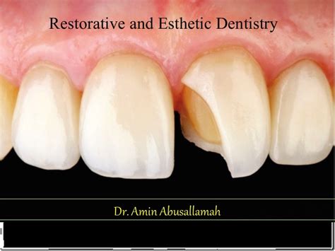 Restorative And Esthetic Dentistry