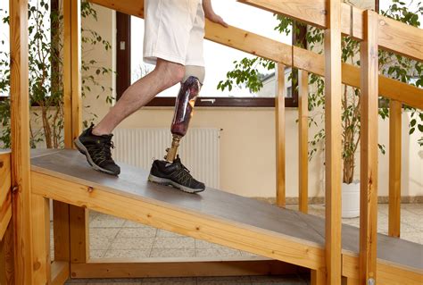 Learning How To Walk On Your New Prosthetic Leg Medical Prosthetics