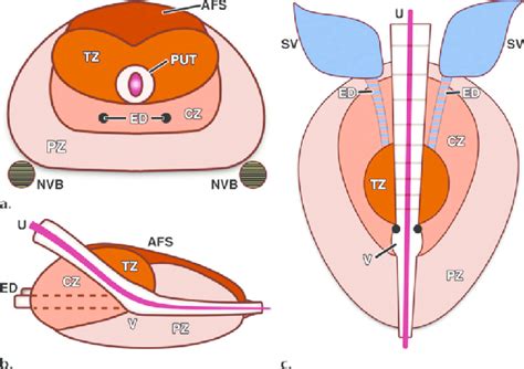 Diagrams Show The Zonal Anatomy Of The Prostate In The Axial A Download Scientific Diagram
