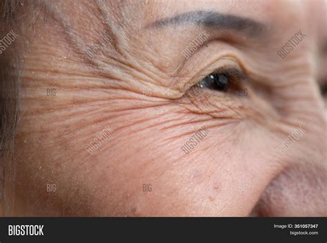 Old Woman Wrinkles On Image And Photo Free Trial Bigstock