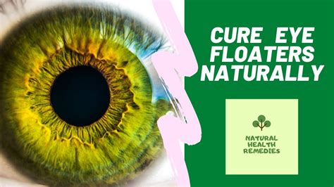 How To Cure Eye Floaters Naturally Youtube