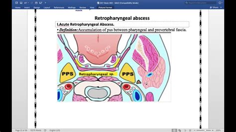 Chapter 5 Retropharyngeal Abscess Part 1 Youtube