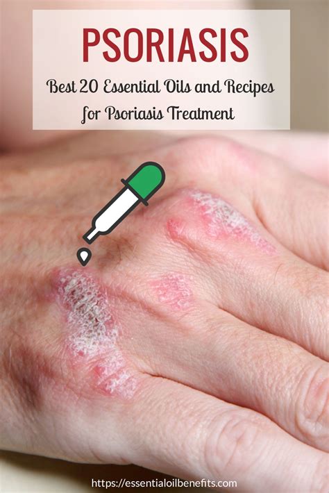 What Are The Best Essential Oils For Psoriasis And What Is The Best