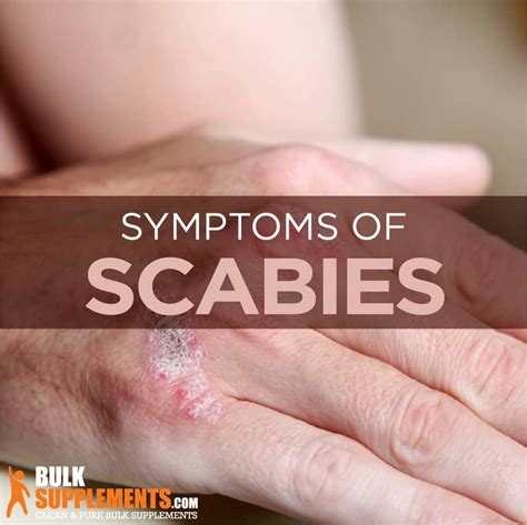 Scabies Symptoms Causes And Treatment