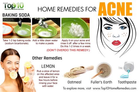 Home Remedies For Acne Top 10 Home Remedies