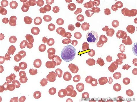 Hematologyoutlines Atlas