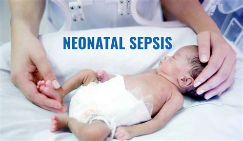 Differing estimates of disease burden have been reported from. Neonatal sepsis | medCampus