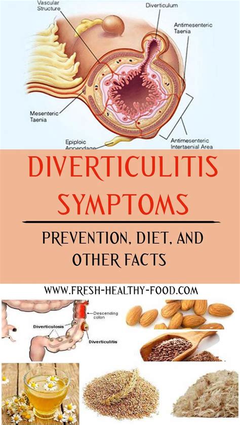 Diverticulitis Causes Signs Symptoms And Treatment Me