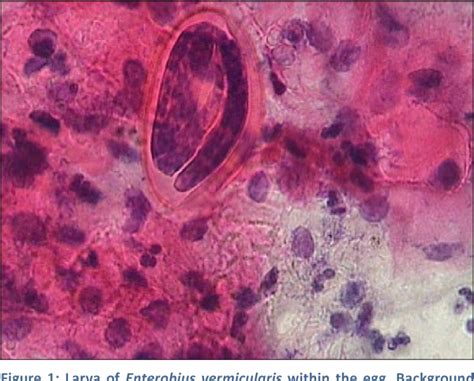 Figure From Eggs Containing Larvae Of Enterobius Vermicularis In