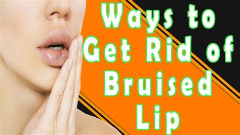 How To Get Rid Of A Bruised Lip Ways To Get Rid Of A Bruised Lip