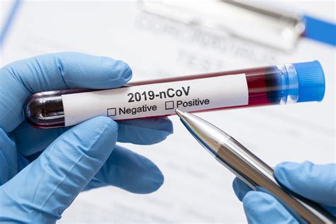 An official website of the national institutes of health. Pandemia coronavirus: recomendaciones para contener el ...