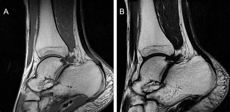 References In Comparison Of 3t And 7t Mri Clinical Sequences For Ankle