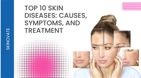 Top 10 Skin Diseases Causes Symptoms And Treatment