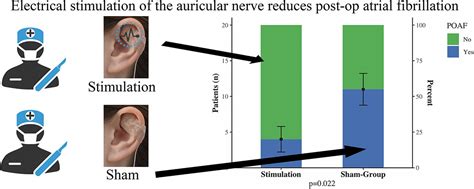 Electrical Stimulation Of The Greater Auricular Nerve To Reduce