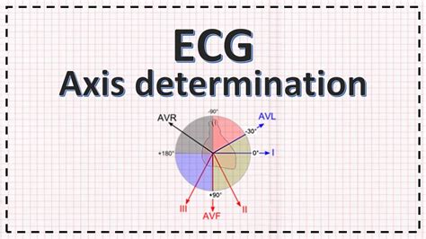 Cardiac Axis Determination Ecg Axis Simplified Youtube