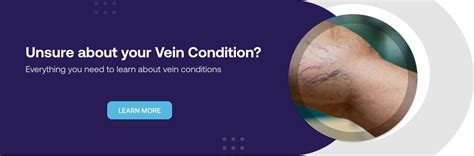 Varicose Vein Clinic Sydney And Melbourne The Vein Institute