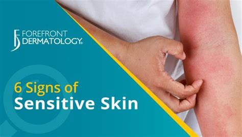 6 Signs You Have Sensitive Skin Forefront Dermatology