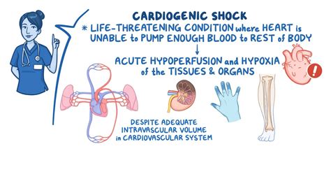 Shock Signs And Symptoms Nursing Mnemonic