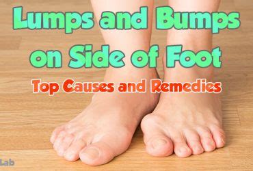 It would be soft at times and hard at other times. Lumps and Bumps on Top of Foot: Causes, Symptoms, and ...
