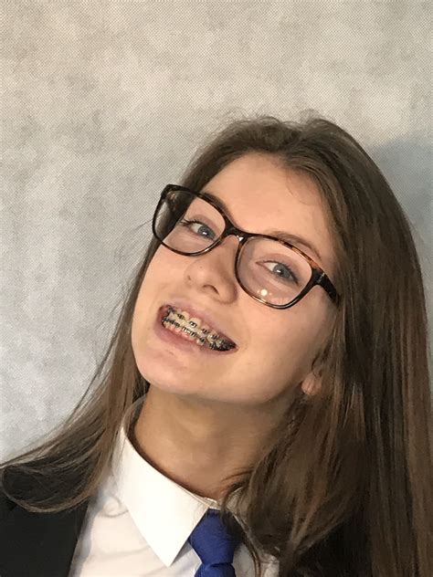 Ideas How To Look Good With Braces And Glasses With Simple Style