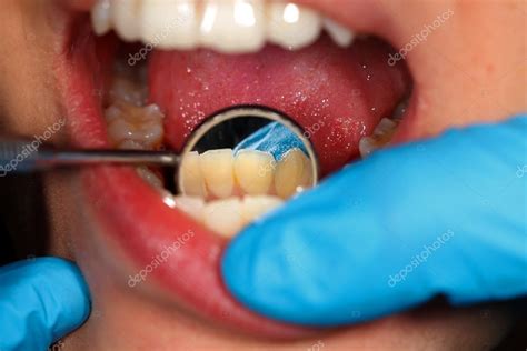 Dental Examination — Stock Photo © Ocskaymark 65360627