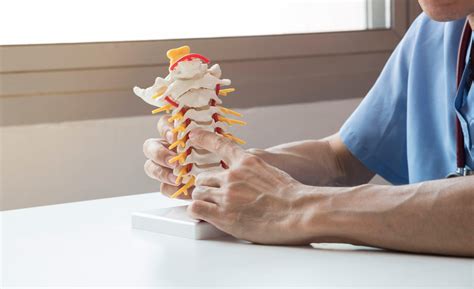 Cervical Radiculopathy Pinched Nerve Plainsboro Township Nj Regenerative Spine And Pain