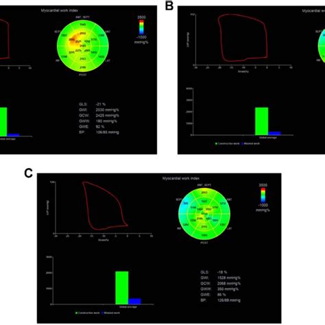 Bull S Eye Of Segments Of Left Ventricular Myocardium A C Are