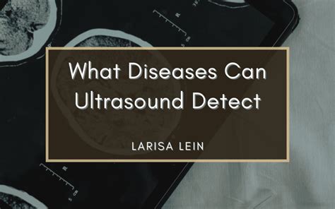 What Diseases Can Ultrasound Detect Larisa Lein Healthcare