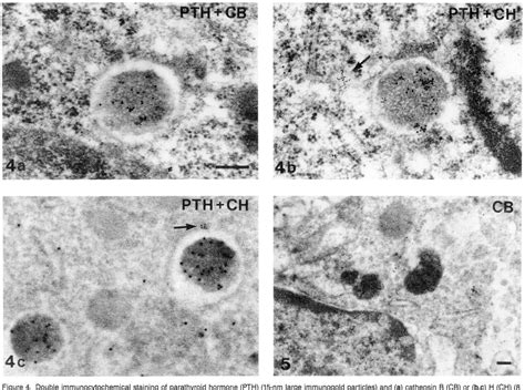 Figure 4 From Cysteine Proteinases In Rat Parathyroid Cells With Special Reference To Their