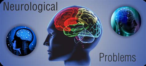 Neurological Problems Causes And Symptoms My Blog