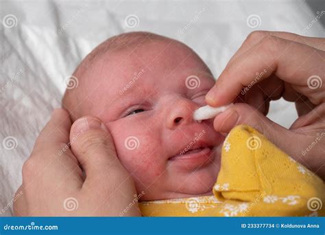 Cleaning Newborn Nose From Boogers With A Cotton Swab Stock Photo
